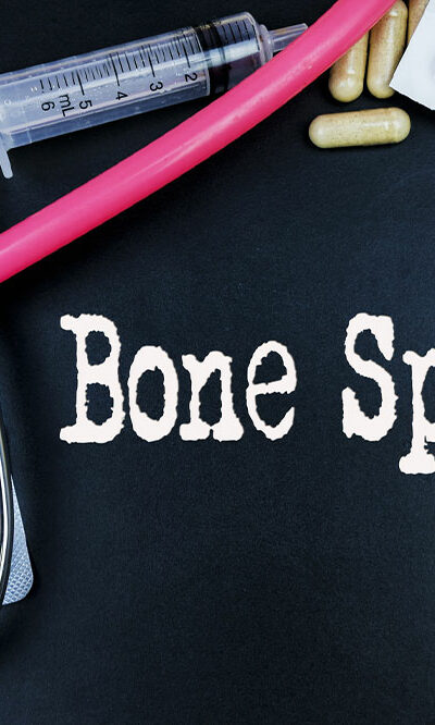 Bone Spurs &#8211; Causes, Types, and Management Options