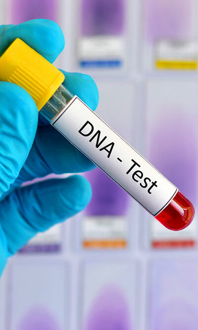 DNA Testing &#8211; Definition, Types, and Procedure