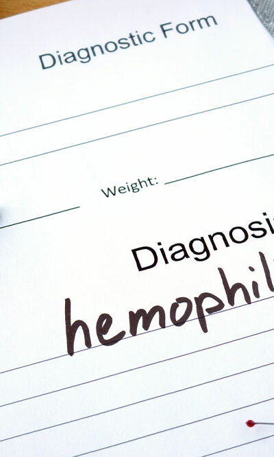 Hemophilia &#8211; Symptoms, Types, and Management Options