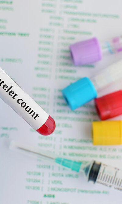 Low Platelet Count &#8211; Ways to Manage the Condition