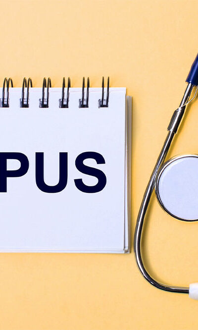 Lupus &#8211; Signs, Causes and Types