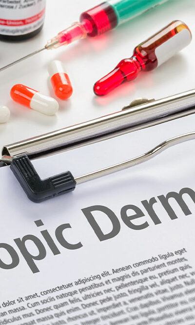 Measures to Manage and Prevent Atopic Dermatitis