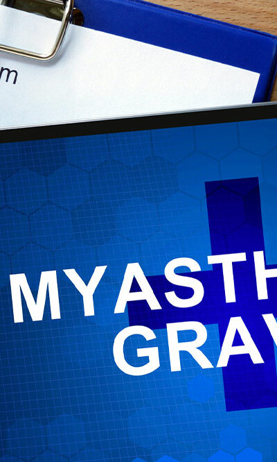 Top Therapies for Those With Myasthenia Gravis