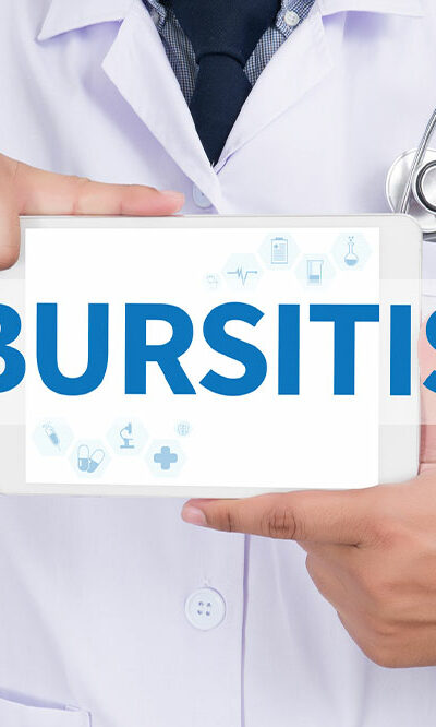 Types and Management Methods of Bursitis