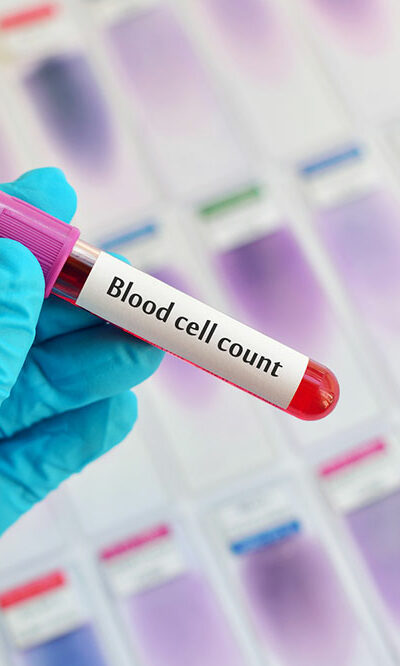 Understanding Different Aspects of Blood Cell Counts