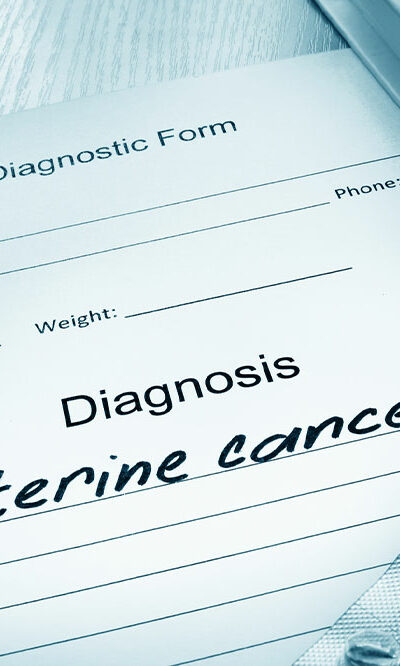 Uterine Cancer &#8211; Its Causes, Symptoms, and Stages