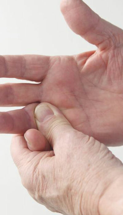 3 common causes of rheumatoid arthritis