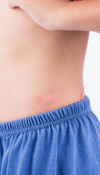 10 common types of skin rashes you should be aware of 