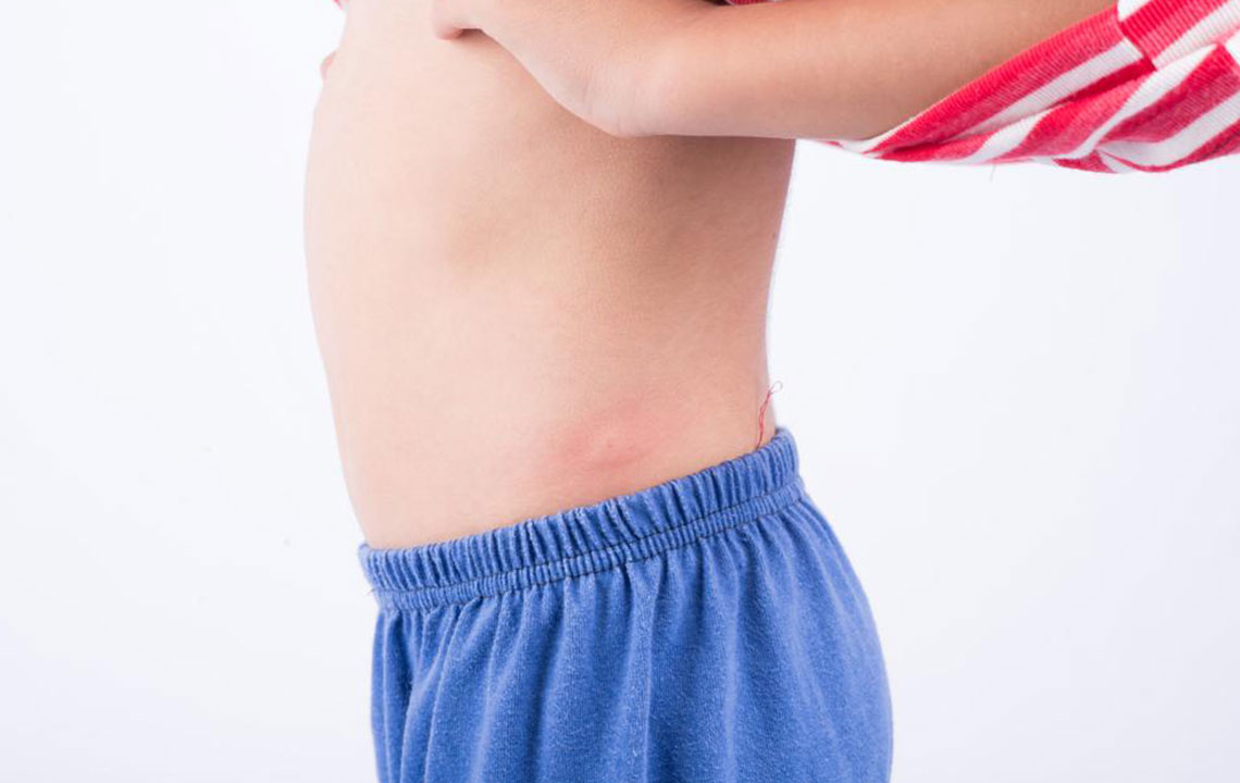 10 common types of skin rashes you should be aware of 