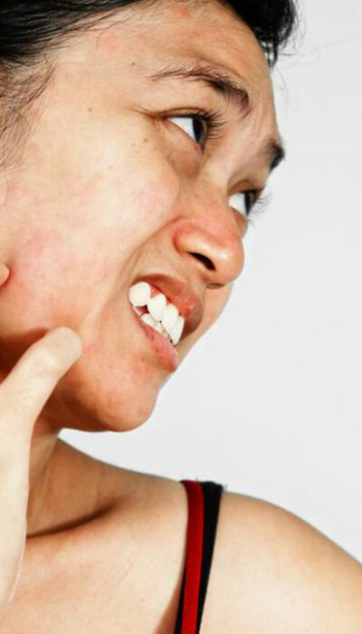 7 easy and useful ways to manage itchy skin