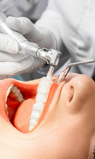 4 Medicare dental plans that cover your dental care