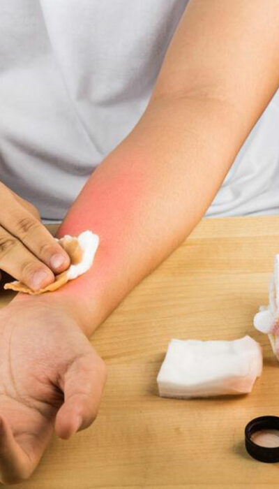 4 common treatments for itchy skin