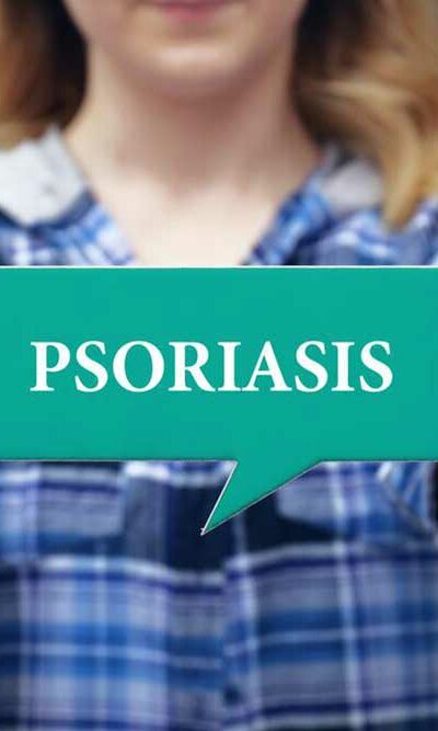 5 Ways to Treat Plaque Psoriasis at Home