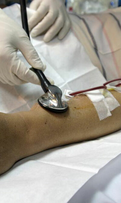 5 useful things a person undergoing kidney dialysis should know