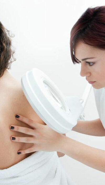 5 ways to reduce the risk of melanoma