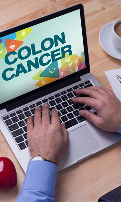 Colon Cancer: Top 3 Signs and Related Symptoms