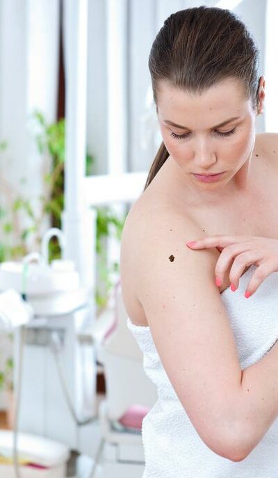 Common Treatments for Melanoma Skin Cancer