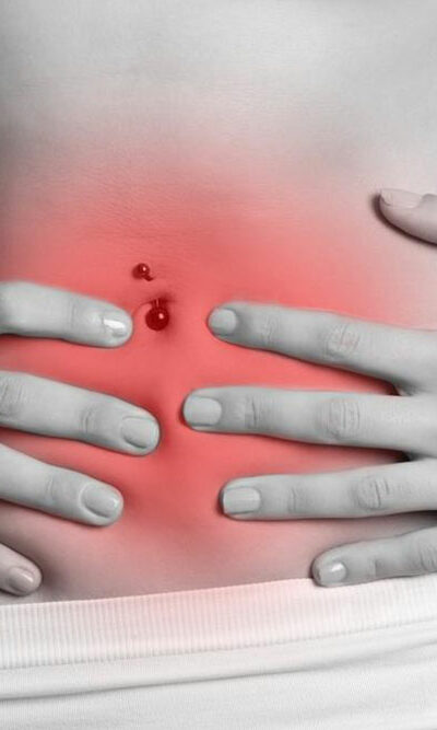 Common colitis symptoms you should be aware of