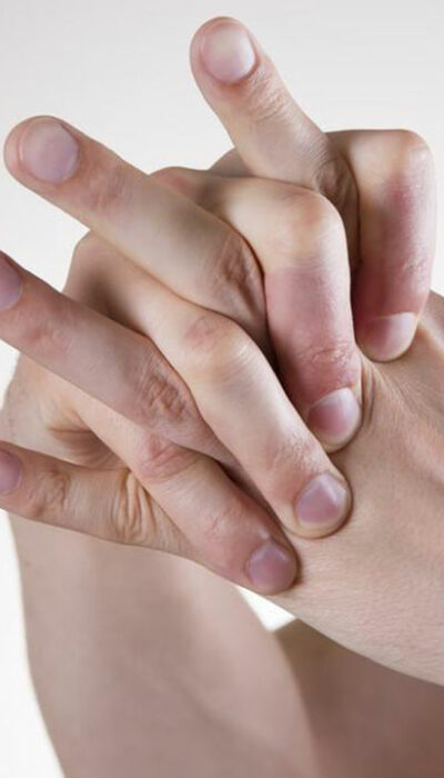 Common differences between rheumatoid arthritis and lupus