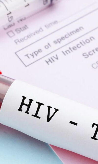 Common signs and symptoms of HIV