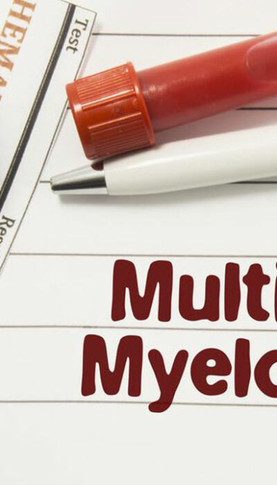 Common types of multiple myeloma and their treatments