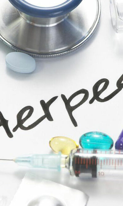 Causes and clinical symptoms of herpes