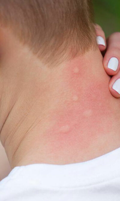 Causes and diagnosis of itchy skin