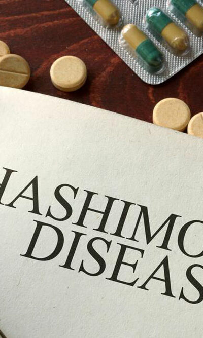 Causes and symptoms of hashimotos disease