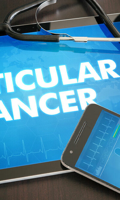 A Brief Overview of Testicular Cancer