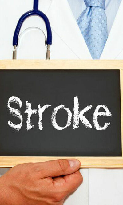 An overview of mini stroke- causes and symptoms explained