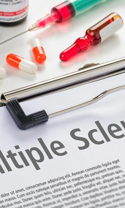 An overview of multiple sclerosis