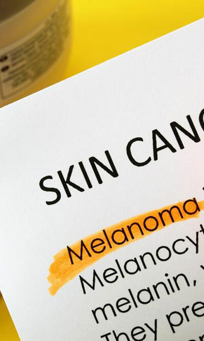 An overview of skin cancer