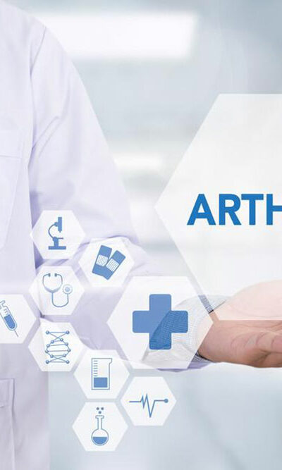 A brief overview of arthritis