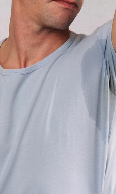 Advanced management of excessive sweating