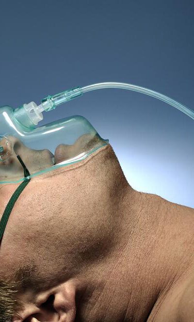 Application of oxygen therapy