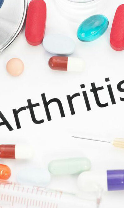 Arthritis &#8211; Classification and treatment