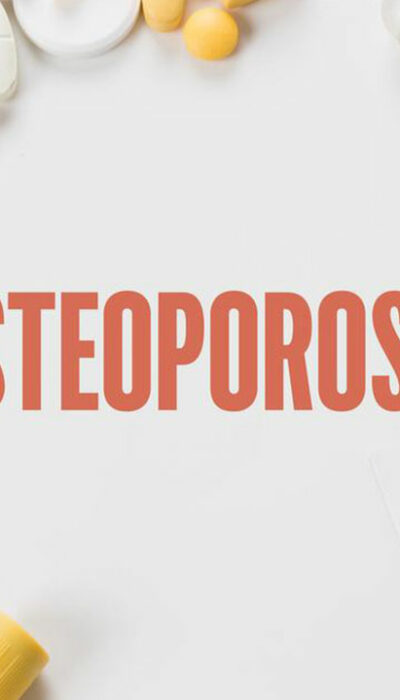 Bone density testing &#8211; An important diagnostic tool for osteoporosis