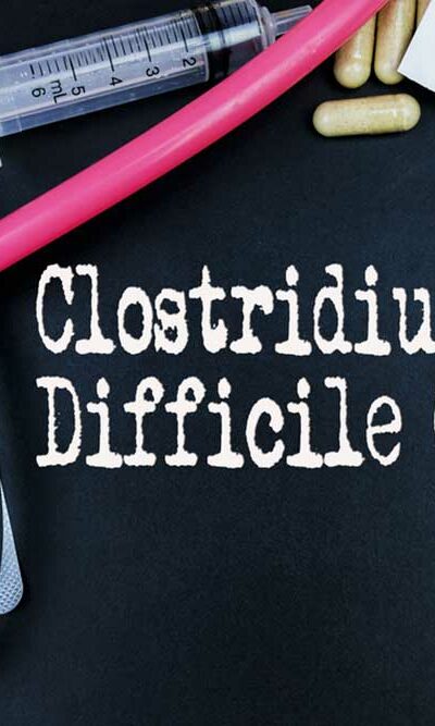 Early Symptoms of Clostridium Difficile Colitis