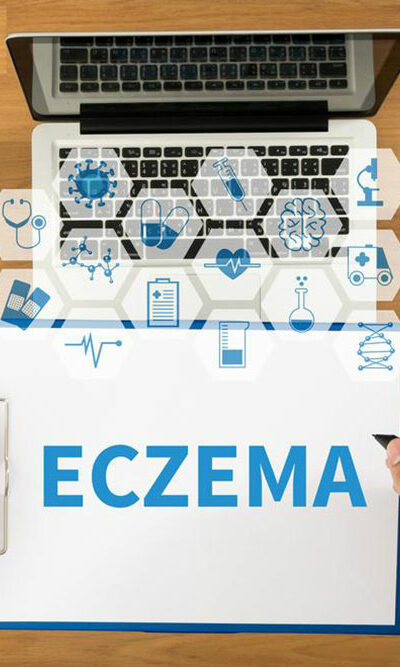 Everything you need to know about eczema