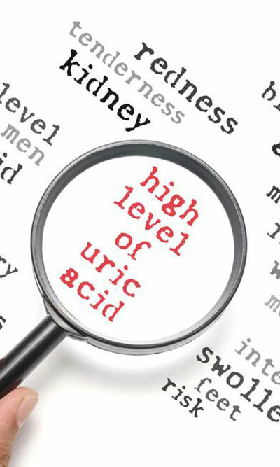 Everything you need to know about high uric acid levels