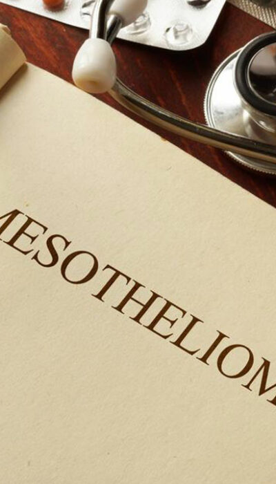 Everything you should know about Mesothelioma