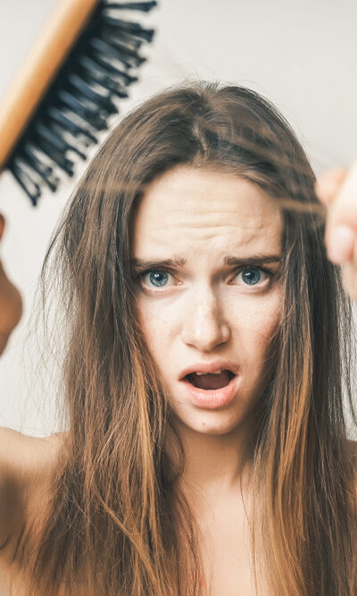 Know Everything About The Hair Loss Treatments