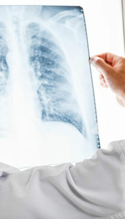 Know all about pulmonary embolisms