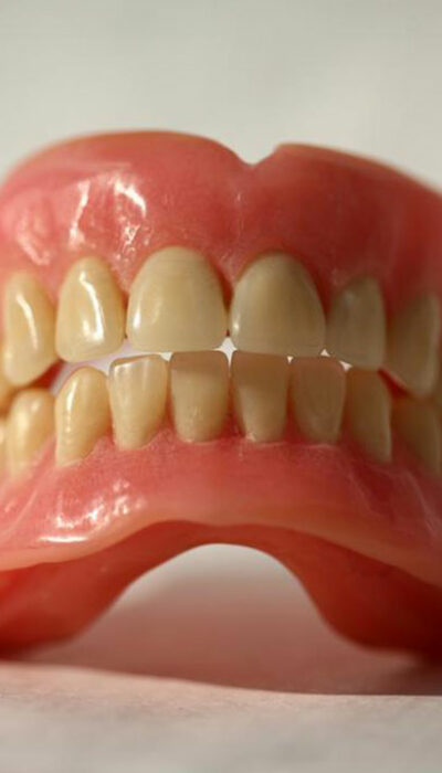 Knowing which foods to have and avoid after dentures