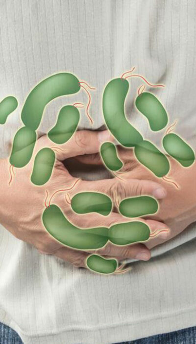 H. pylori Infection – Causes, risk factors, and complications