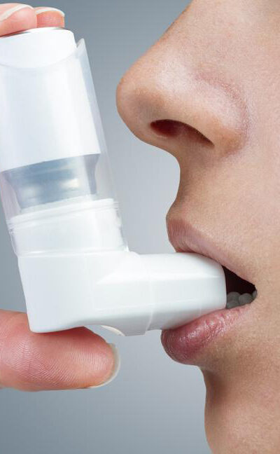 How is severe asthma treated?