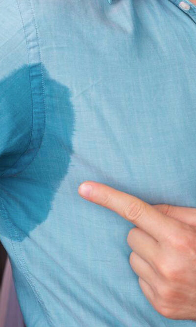 How to tackle excessive sweating