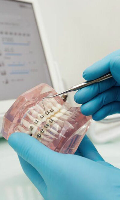 How to find affordable dentures?