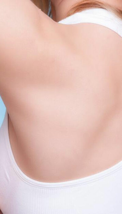 How to get rid of candida armpit rash