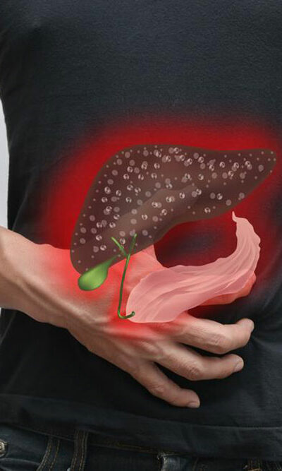 How to maintain good gallbladder health